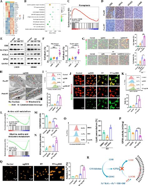 GSS Contributes To GBM Cell Resistance To Radiotherapy Induced