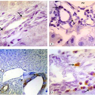 Photomicrograph of liver tissue in the control (a), liver injury (b ...