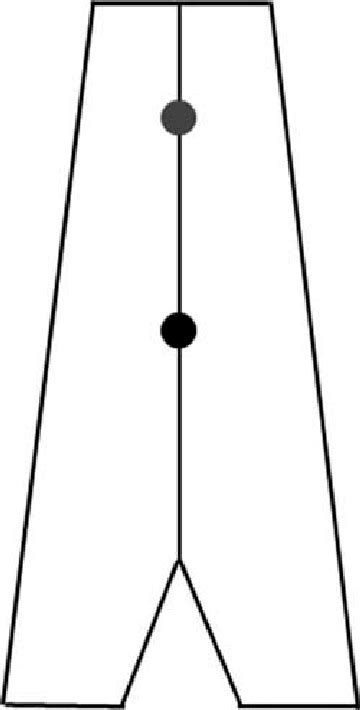 Physiological Diplopia Card The Patient Becomes Aware Of Physiological