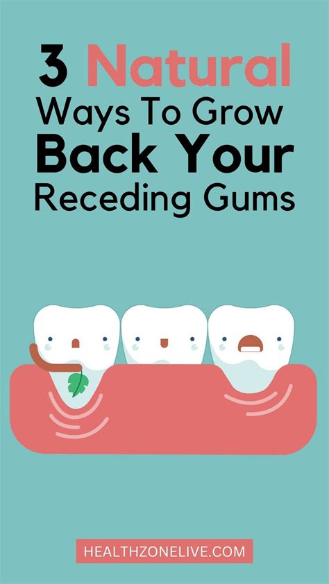 Grow Back Receding Gums Artofit