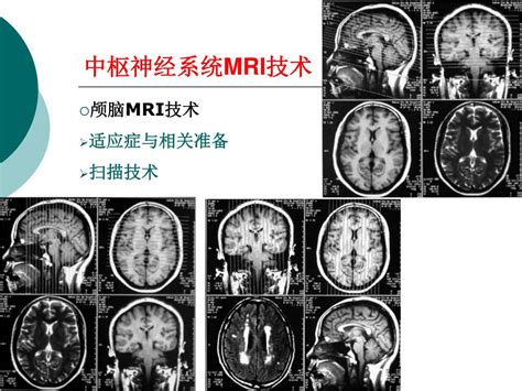 Ppt Mri The Basic Principles And Clinical Application Of