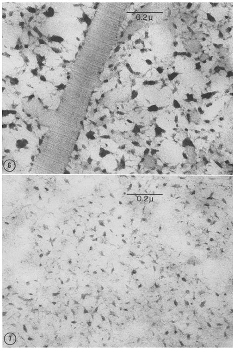 Figure From The Fine Structure Of Bovine Nasal Cartilage Extraction