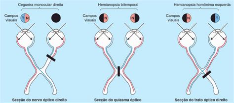 Principais lesões dos nervos cranianos Anatomia Fisioterapia