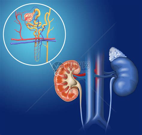 肾单位结构的3d插图肾的基本结图片素材 正版创意图片402388100 摄图网