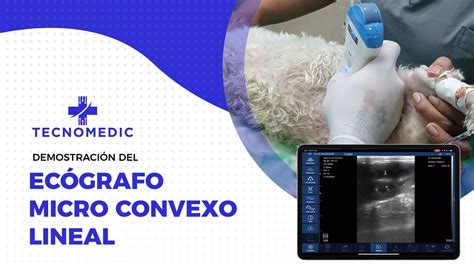 Tecnomedic Demostraci N Del Ec Grafo Micro Convexo Lineal Youtube