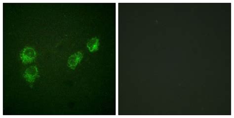 Phospho Pln Ser16 Thr17 Antibody Pa5 38317 In If Thermo Fisher