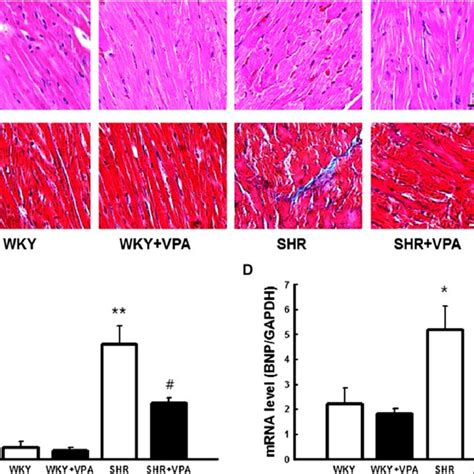 Effect Of Vpa Treatment On Cardiac Hypertrophy And Fibrosis Analyses