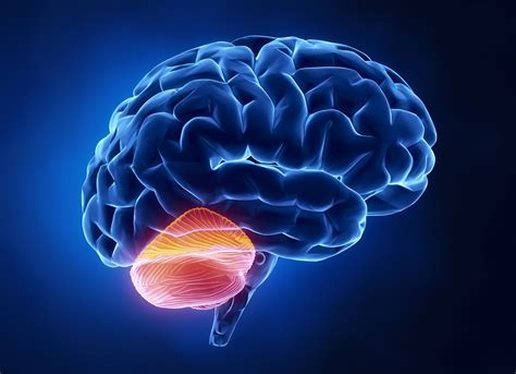 chiari malformation surgery death rate