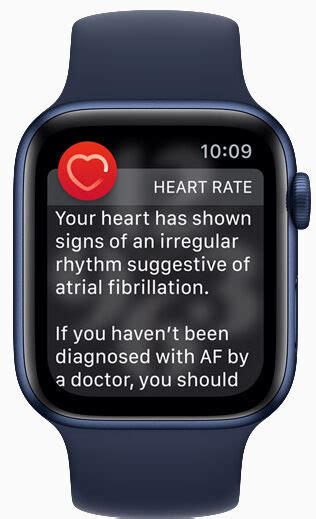 Apple Irregular Rhythm Notification Feature Software Instructions