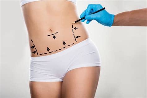 Cirurgia plástica para o abdômen além da abdominoplastia Dr André