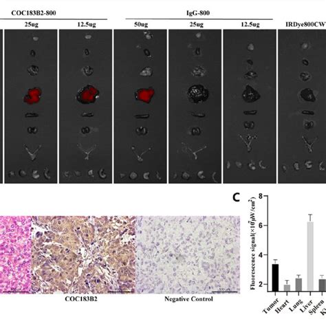 Immunohistochemical Ihc Staining Of Ovarian Cancer Tissues With