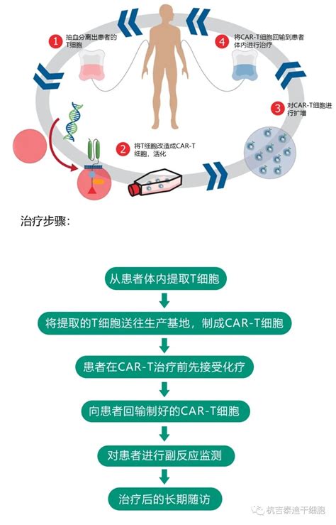 一针310万国产CAR T细胞免疫疗法获欧盟批准上市 杭吉干细胞科技