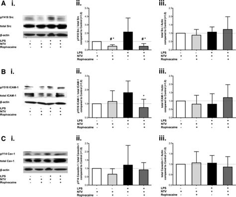 Effect Of Ropivacaine On Phosphorylation And Expression Of Src Icam