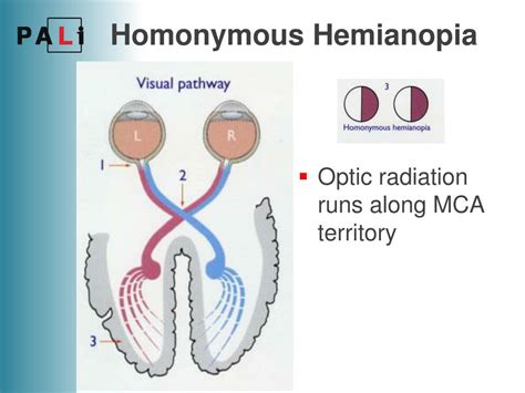 Ppt Neurology Powerpoint Presentation Id 681193