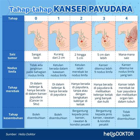 Ciri Ciri Sakit Payudara Homecare24