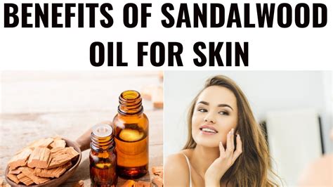 Sandalwood Essential Oil Benefits