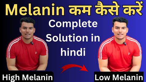 How To Remove Melanin From Body Naturally Melanin Kam Karne Ke Upay