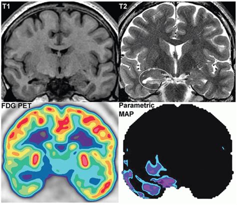 Central Nervous System Radiology Key