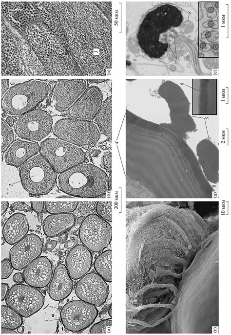 Microstructure Of Gonads And Ultrastructure Of Mature Sex Cells In