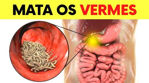 MEBENDAZOL para VERMES O que você PRECISA SABER Como Tomar Riscos