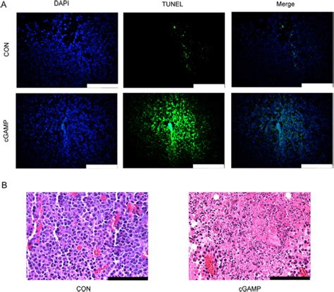 Gamp Induces Apoptosis Of Tumors A Tunel Assay Of Tumor Tissues