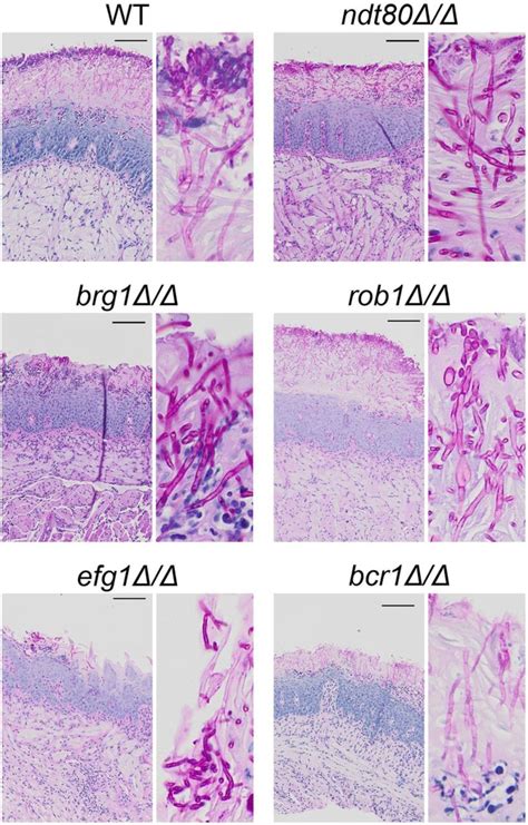 Candida Albicans Histology