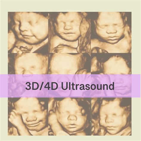 Home - Affordable 3D/4D Ultrasound in Houston Texas