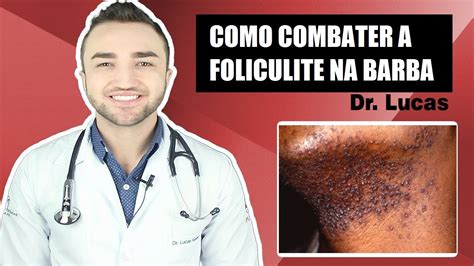 Saiba Como Tratar Foliculite Na Barba Dicas Do Dr Lucas Fustinoni