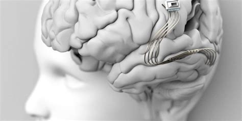 How does a brain implant affect your mind? | Newstalk