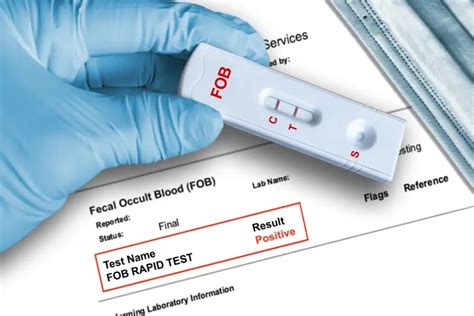 Stool Test Fobt Fit In Singapore What To Do If It S Positive