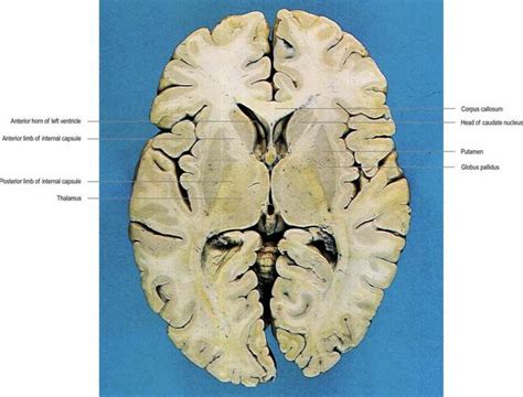 Basal Ganglia Of Brain