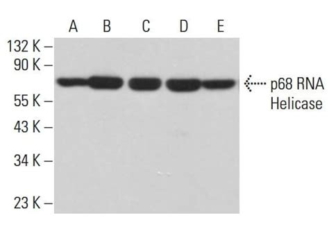 p68 RNA Helicase抗体 A 5 SCBT Santa Cruz Biotechnology