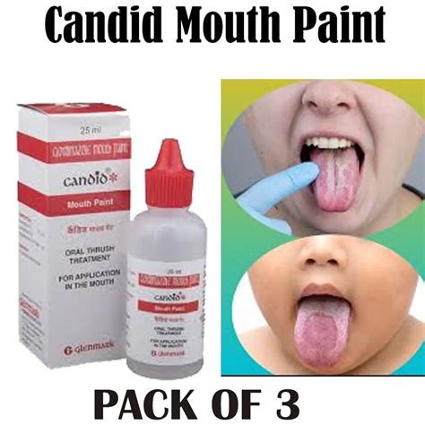 Candid Mouth Paint For Oral Thrush Treatment For Kills Fungal Infection