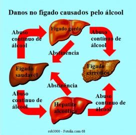 Cirrose Hepática Tem Cura - Tratamento para a cirrose hepática, diagnóstico, dieta e transplante