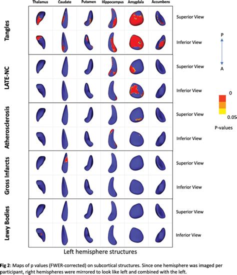 Associations Of Subcortical Shapes With Age‐related Neuropathologies In