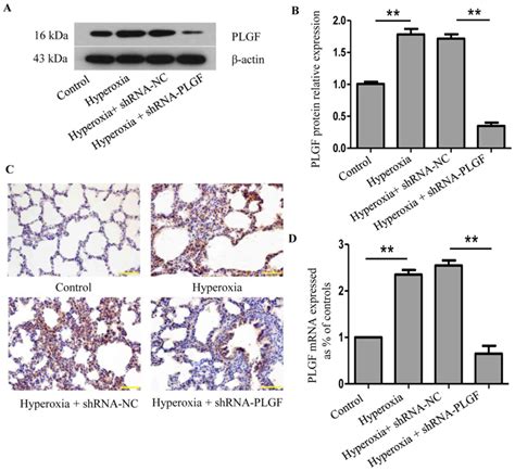 Placental Growth Factor Gene Silencing Mitigates The Epithelialto