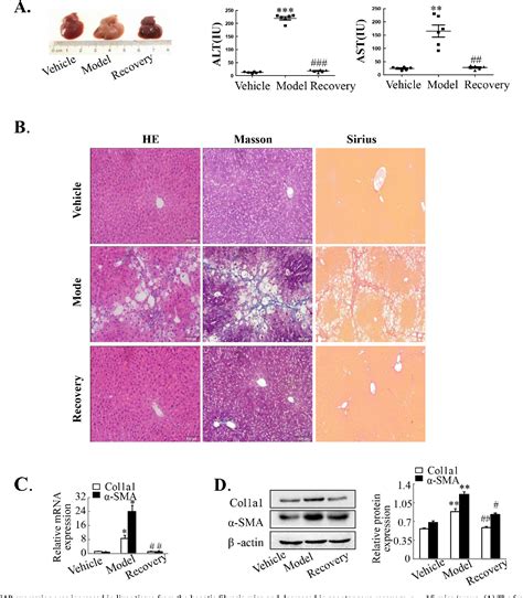 Figure 1 From Blockade Of YAP Alleviates Hepatic Fibrosis Through