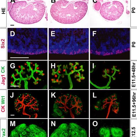 Osr1 Wt1 Embryos Exhibit Defects In Ureteric Bud Branching A C