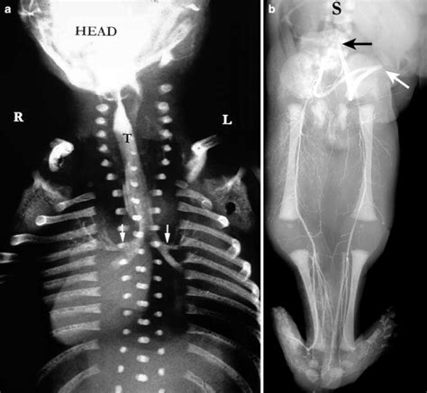 Pediatric Autopsy Fetus Newborn And Child Springerlink