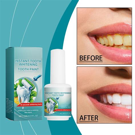 Teeth ning for Sensitive Teeth And Gums Instant Teeth Artery Plaque ...