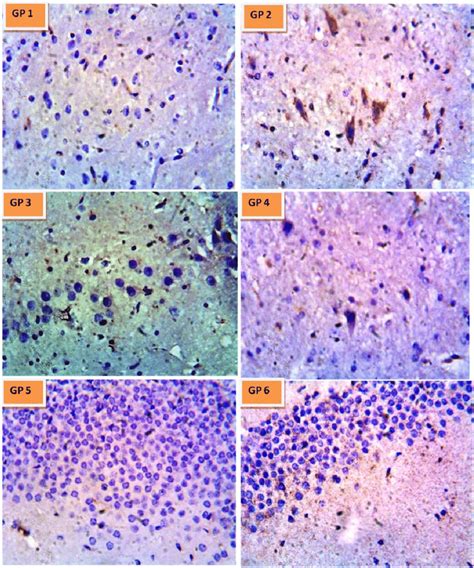 Photomicrograph Showing Immunohistochemistry Labelling Of Neuron