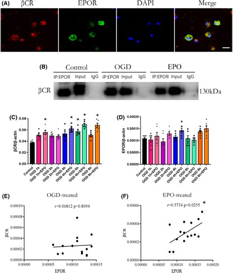 EPOR βCR heterodimer exists on primary neural stem and progenitor