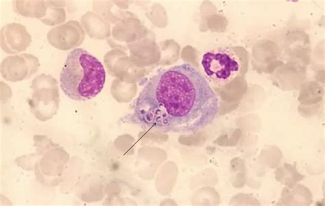 Histoplasma Capsulatum And Histoplasmosis Current Concept For The Diagnosis Intechopen