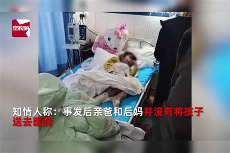 4岁女孩疑遭后妈虐待，双脚烧伤险被截肢，知情人：亲爸后妈被抓后妈虐待知情人