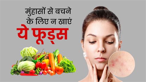 मुंहासों का कारण बनती हैं ये 8 चीजें आज से ही बना लें दूरी Acne