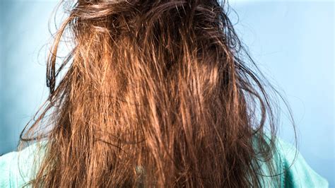 Why Is Your Hair Greasy After Washing It Heres What Might Be Causing It