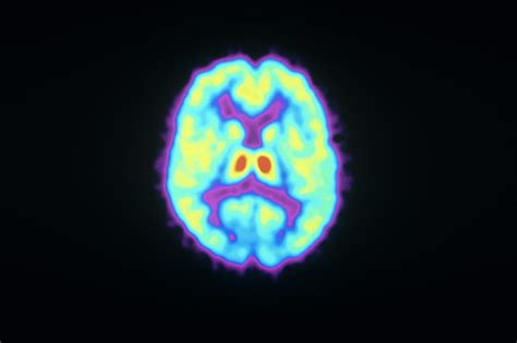 Opioid Receptors Photograph By Philippe Psailascience Photo Library