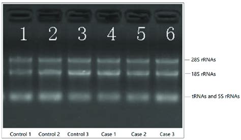 RNA Integrity And Genomic DNA Contamination Examined By Denaturing