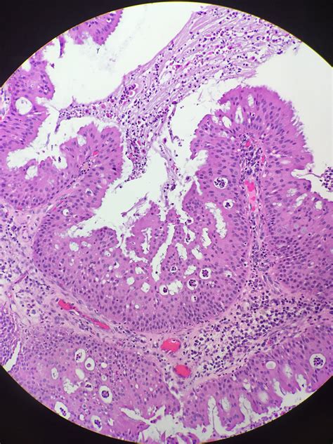 Vumc Pathology On Twitter Rt Megothelioma One Of My Favorite