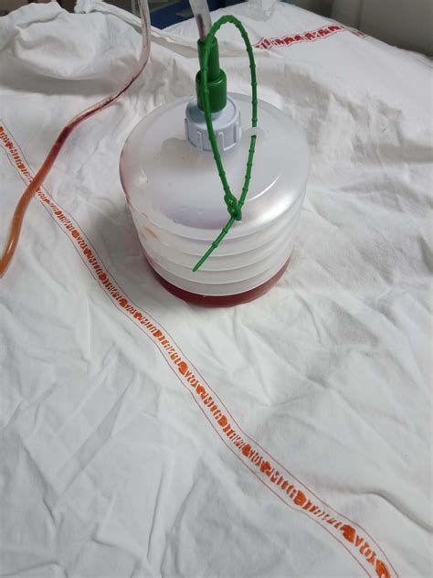 Drains In General Surgical Practices Surgical Technology